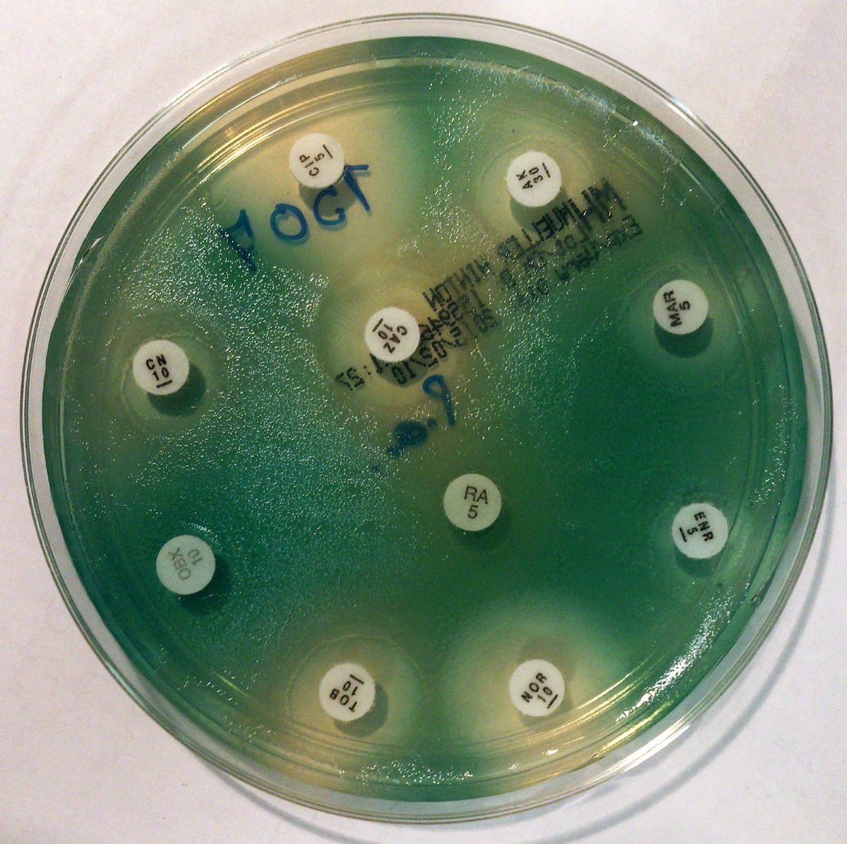 Antibiograma de Pseudomonas aeruginosa en Mueller-Hinton con pigmento verde