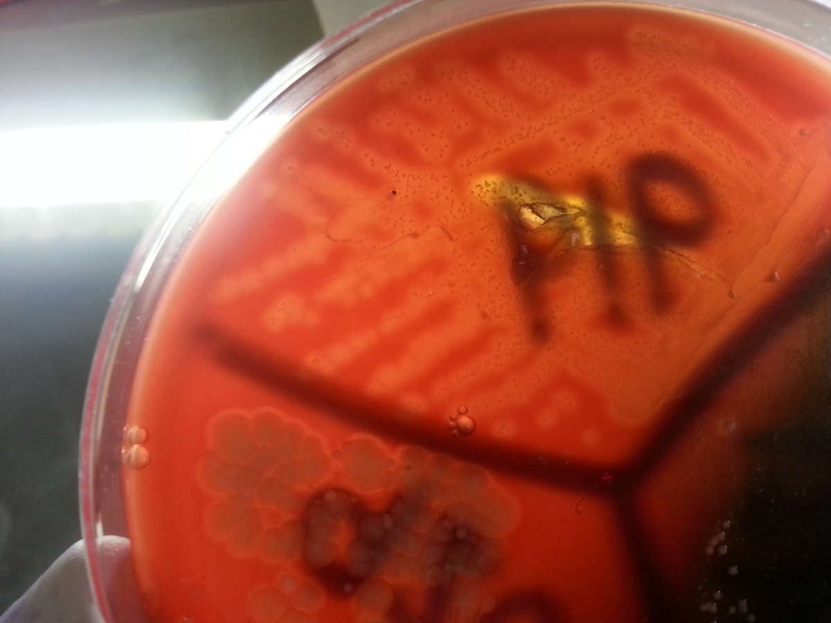 Agar sangre con colonias beta-hemolíticas