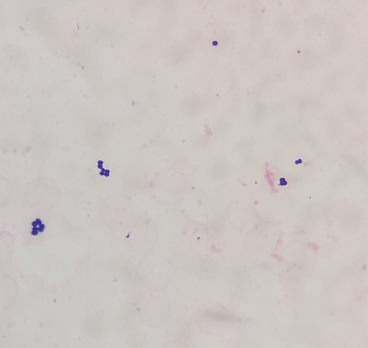Gram de hemocultivo positivo con cocos grampositivos
