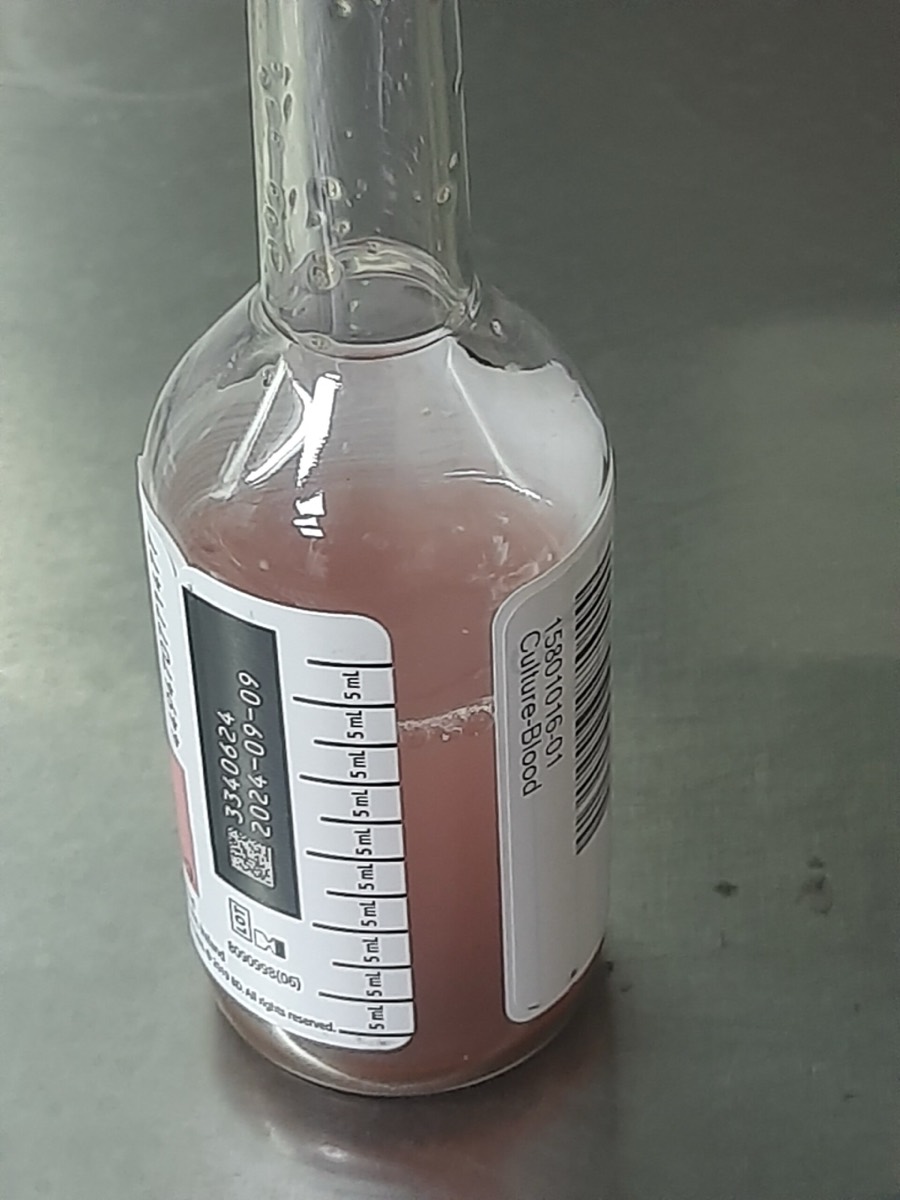 Frasco de hemocultivo automatizado turbio por crecimiento bacteriano