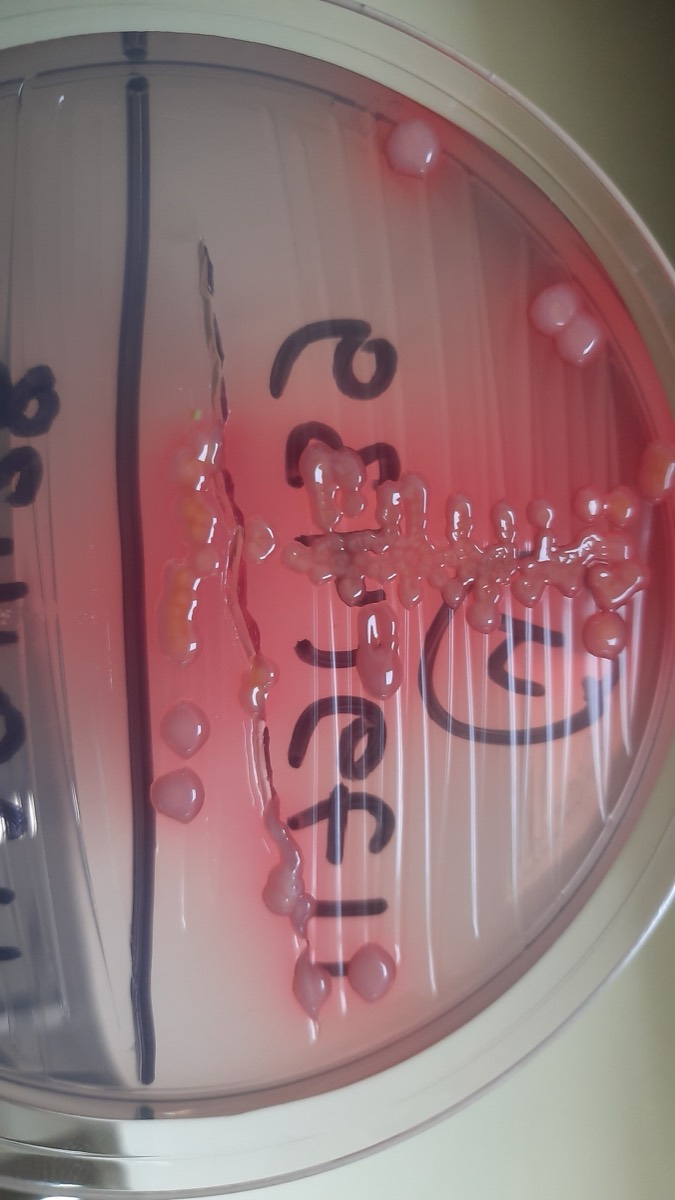 Agar CLED con colonias amarillas de Klebsiella