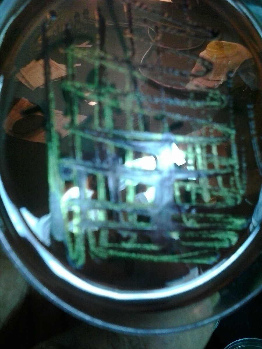 Agar EMB con brillo verde metálico de E. coli