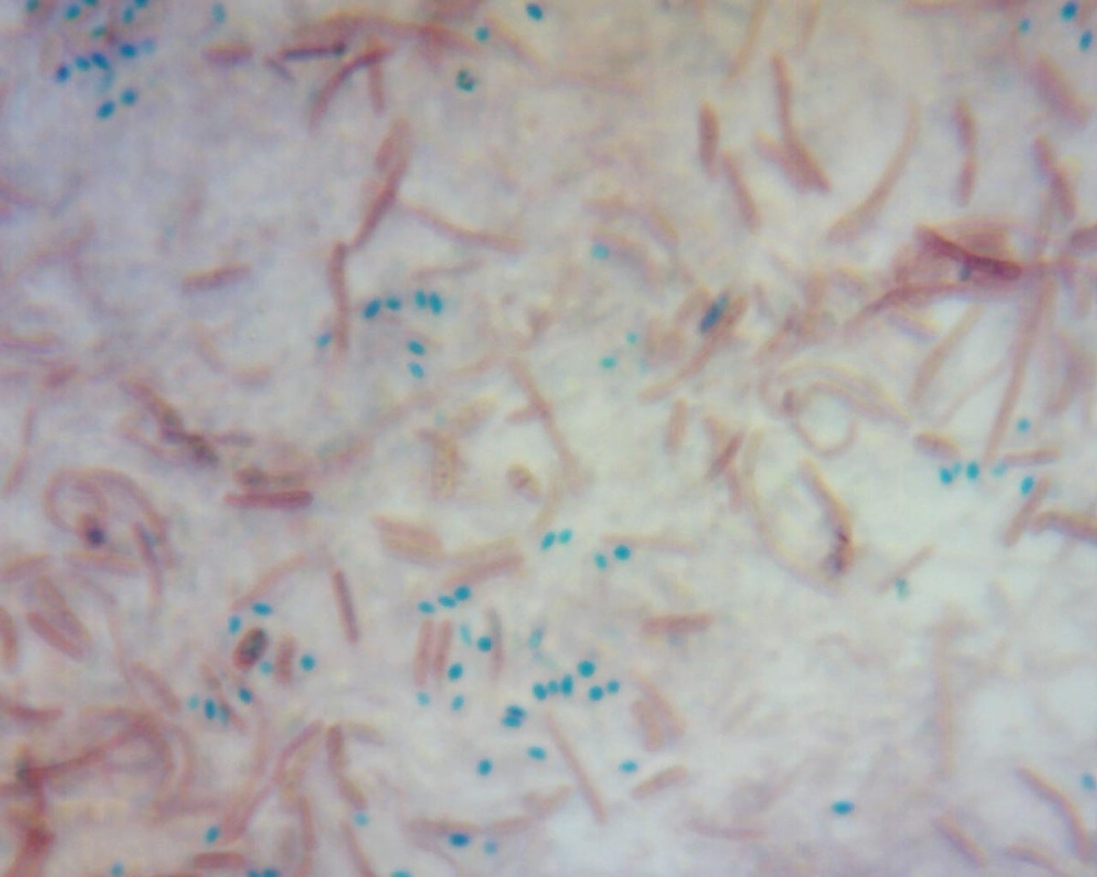 Endosporas teñidas de verde dentro de bacilos rosados