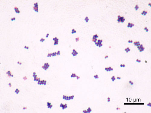 Frotis delgado de Staphylococcus aureus con cocos violeta bien separados y barra de escala