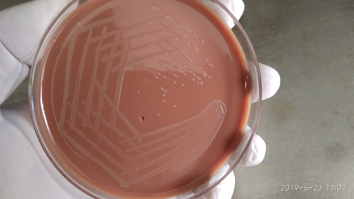 Agar chocolate con colonias de Haemophilus influenzae