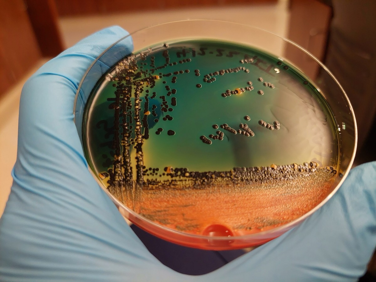 Agar Hektoen con colonias verdes y naranjas