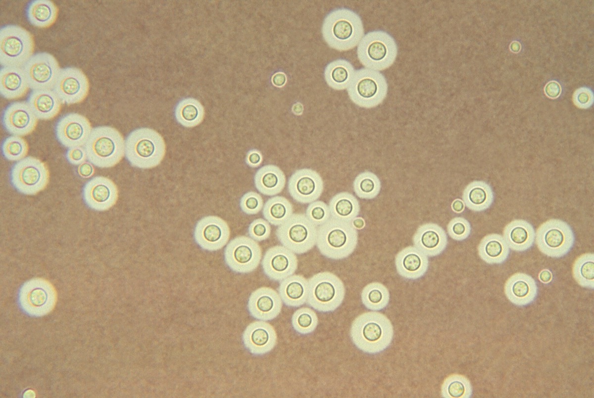 Levaduras encapsuladas de Cryptococcus con tinta china
