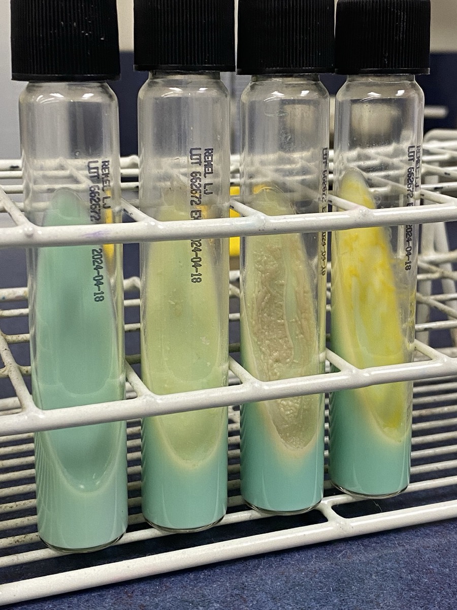 Tubos inclinados de Löwenstein-Jensen con crecimiento de distintas micobacterias