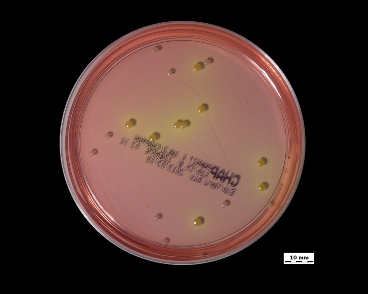 Agar manitol salado con colonias amarillas