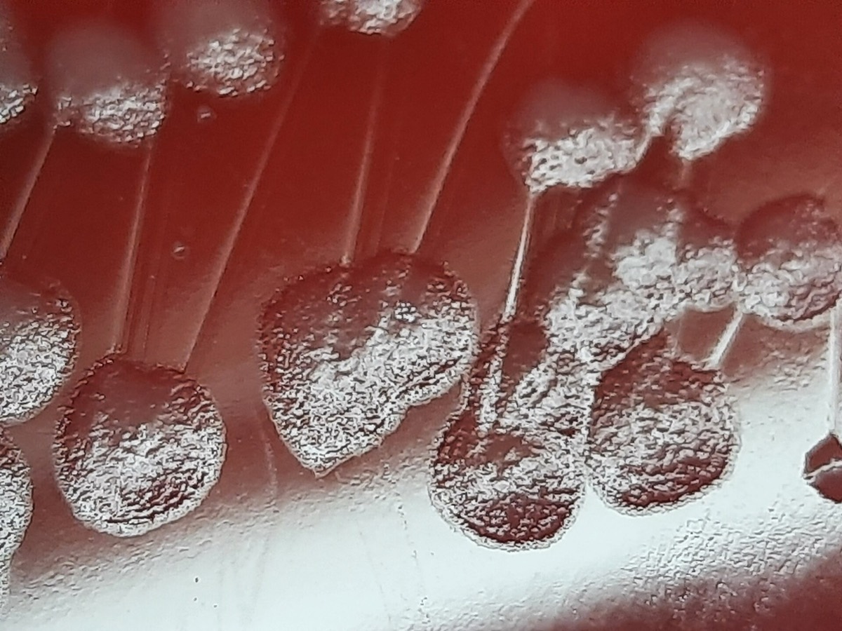 Colonias de Pseudomonas aeruginosa con brillo metálico
