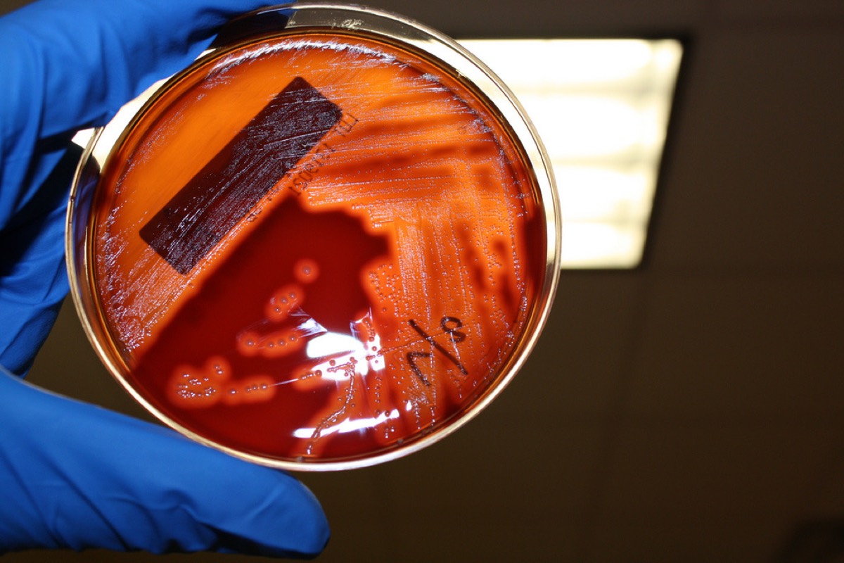 Streptococcus pyogenes con amplia beta-hemólisis en agar sangre