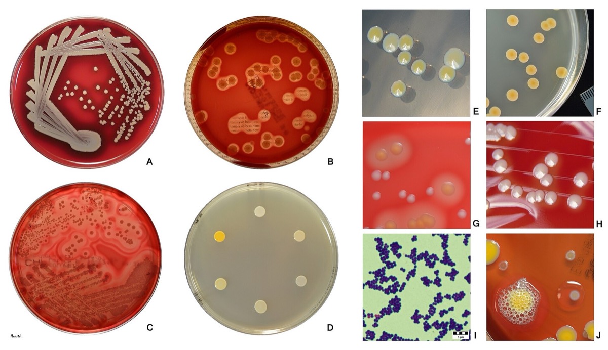 Colonias de Staphylococcus aureus en agar sangre y otros medios