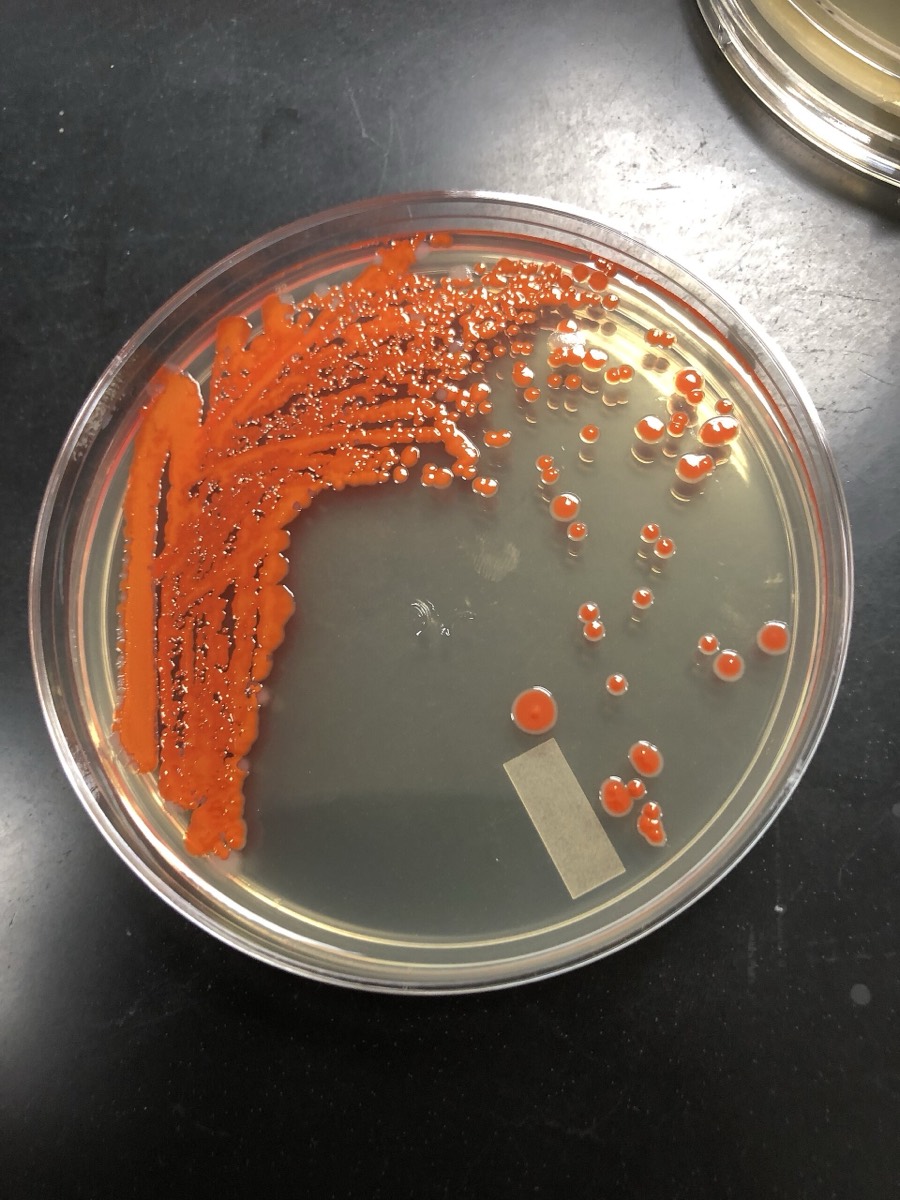 Placa sembrada por agotamiento con colonias rojas aisladas de Serratia marcescens