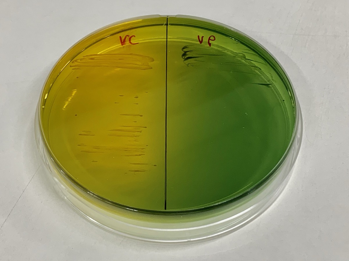 Agar TCBS con colonias amarillas y verdes de Vibrio