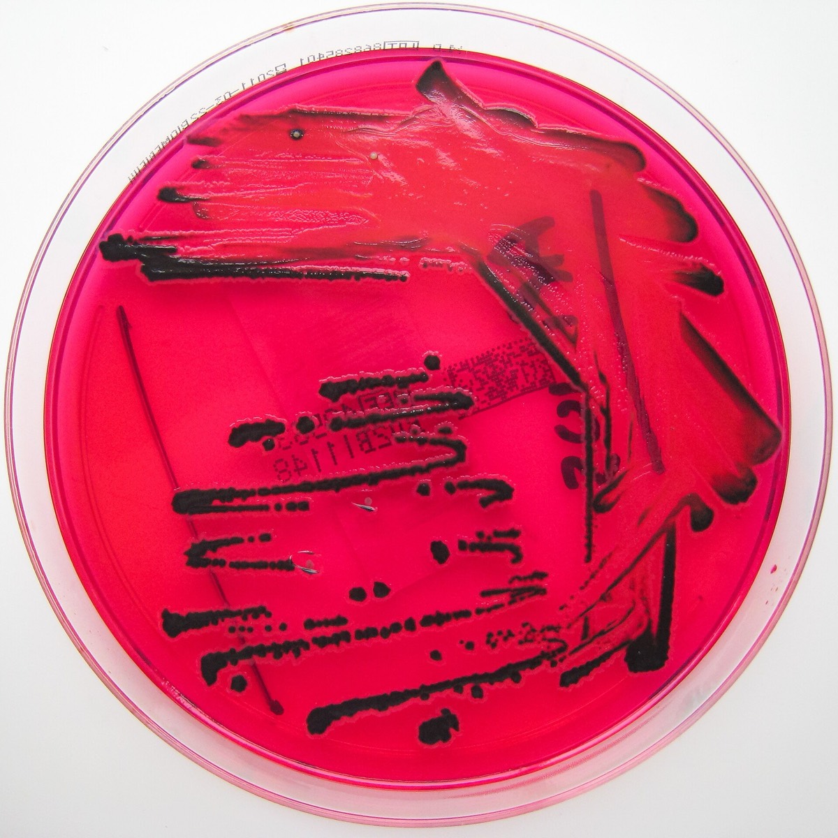 Agar XLD con colonias rojas con centro negro de Salmonella